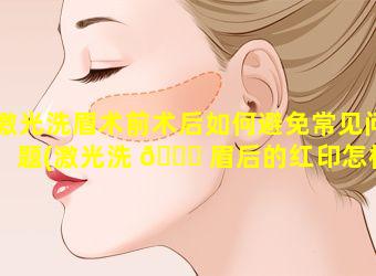 激光洗眉术前术后如何避免常见问题(激光洗 🐕 眉后的红印怎样能快速消除 🌿 )